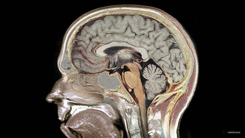 Uma região escondida no cérebro humano foi descoberta 1